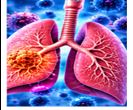 Respiratory Infections
